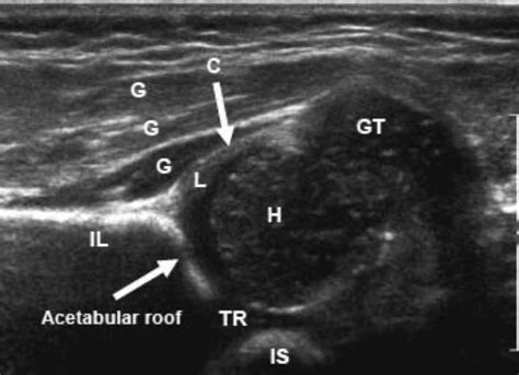 Topic - Postgraduateorth Opaedics