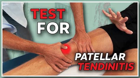 How To Diagnose Patellar Tendinitis The Nr 1 Test Youll Need Youtube