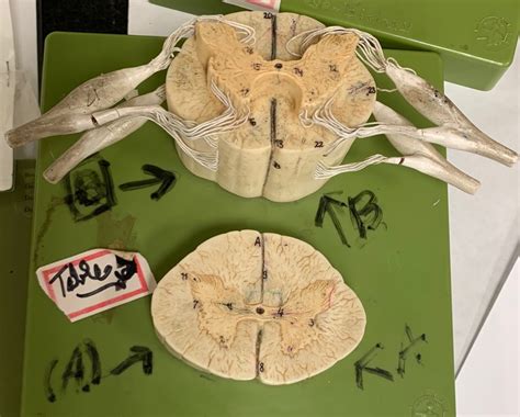 Lab Practical 3 Spinal Cord Label Diagram Quizlet