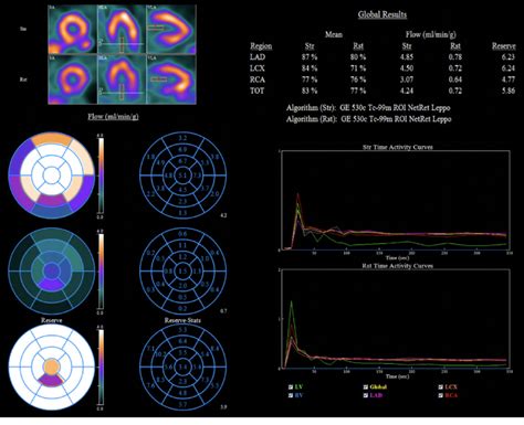 Myocardial Blood Flow And Flow Reserve Follow Up Evaluation Global