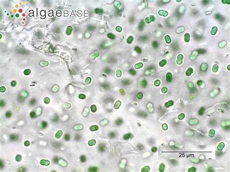 Synechococcus - Alchetron, The Free Social Encyclopedia