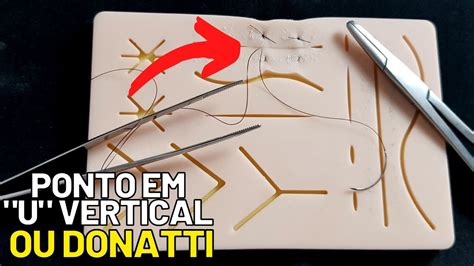 Como Fazer Um PONTO EM U VERTICAL DONATTI Sutura De Pele Fio