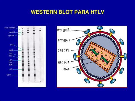 PPT - A RELEVÂNCIA DA TESTAGEM OBRIGATÓRIA DO HTLV NOS EXAMES ...