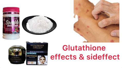 Glutathione Effect And Sid Effect Skin Bleachingcream Whitning