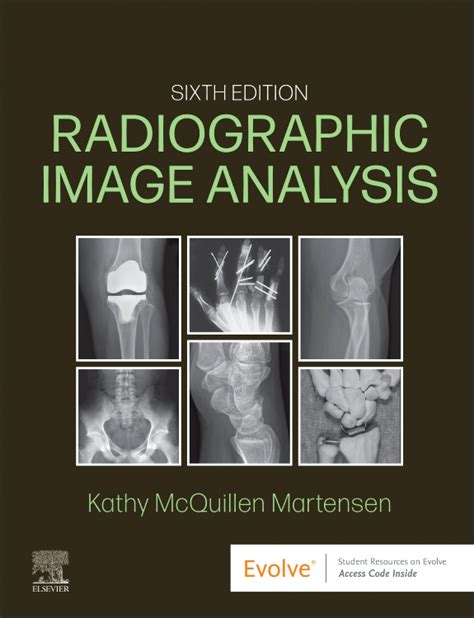 Manual de radiología para técnicos Edition 12 By Stewart C Bushong