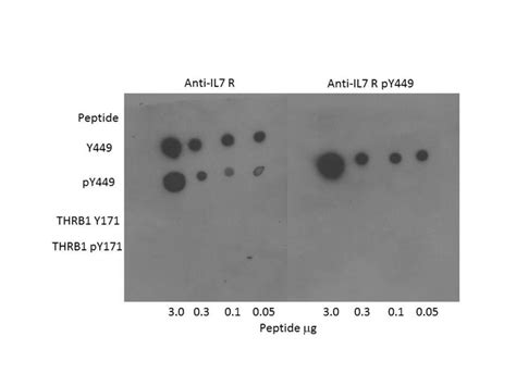 Ihc Plus™ Il7r Cd127 Polyclonal Antibody Rabbit Anti Human Lsbio