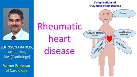 Rheumatic Heart Disease Youtube