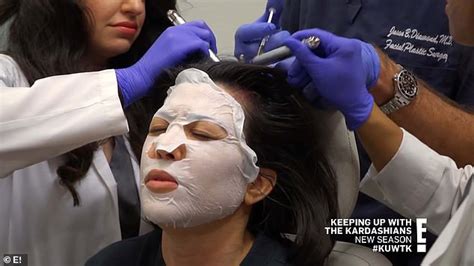 Kourtney Kardashian reveals plasma injections for a 'bald' spot, caused ...