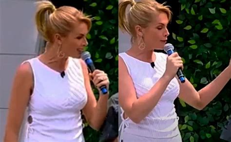 Veja hematoma no braço de Ana Hickmann após agressão