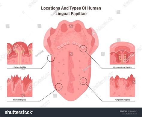 Normal Foliate Papillae