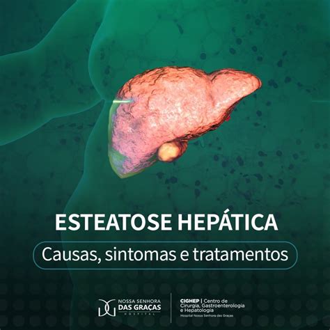 Esteatose Hepática Causas sintomas e tratamento Cighep