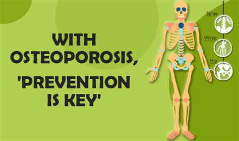 With osteoporosis, 'prevention is the key' - The Wellness Corner