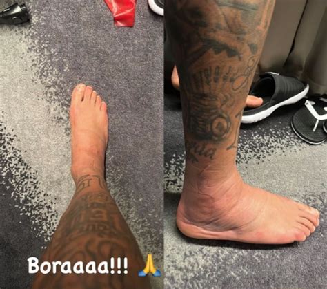 Ainda O Tornozelo Inchado Neymar Posta Foto Do P Ap S Les O