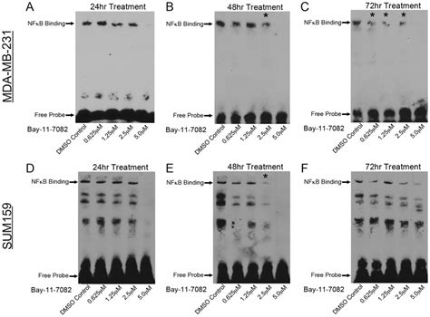 Bay 11 7082 Inhibits Nf κb Binding To Dna In Breast Cancer