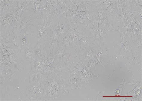 正常人表皮角质形成细胞 Nhek（有str鉴定）细胞系细胞库旗赛生物科技（武汉）有限公司