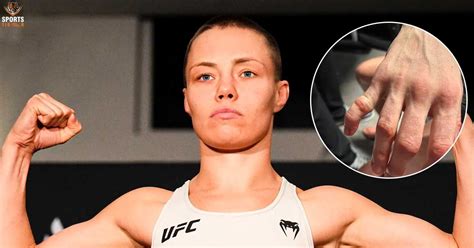 Rose Namajunas Hand Injury Rose Namajunas Ufc Fight Rose Namajunas