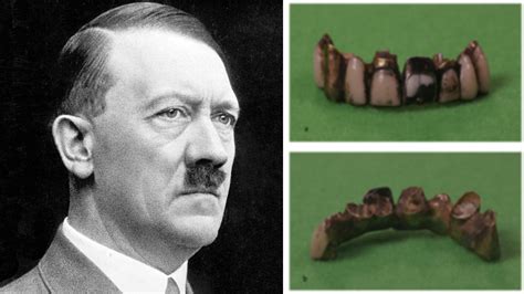 Forensic Analysis Of Hitlers Teeth Debunks Long Held Conspiracy