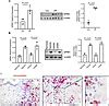 Jci Insight Hypoxia Enhances Ipf Mesenchymal Progenitor Cell