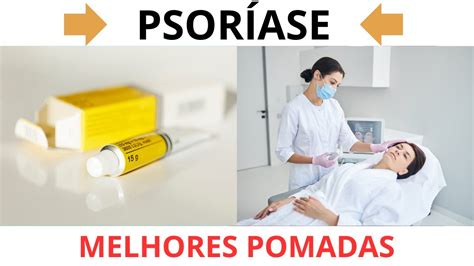 Psoríase Melhores Pomadas Para o Tratamento YouTube