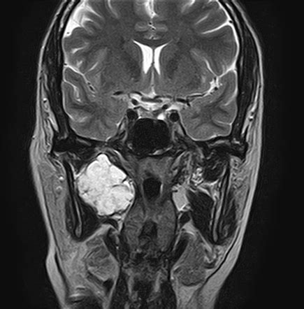 Radiology Quiz 68833 Radiopaedia Org