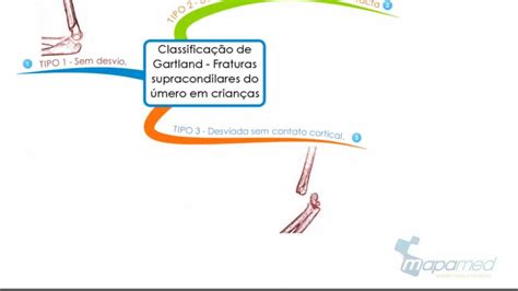 Classificação De Gartland Fraturas Supracondilianas Em Umero De