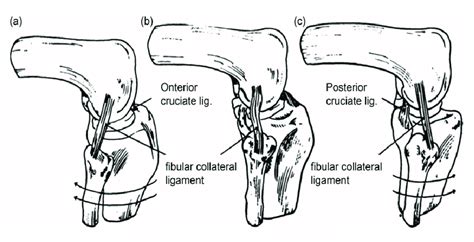 The Lateral Collateral Ligament Fibular Collateral Ligament Fcl Download Scientific Diagram