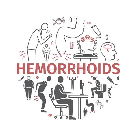 Hemorrhoids Stock Vector Illustration Of Buttock Hemorrhoidal 74992981