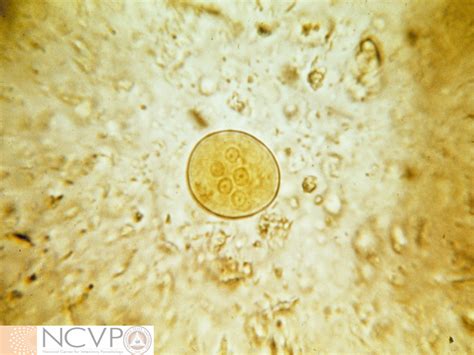 Entamoeba Spp Ncvp National Center For Veterinary Parasitology