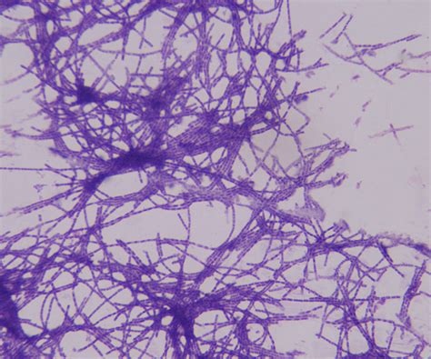 Bacillus Anthracis Gram Stain Gram Stain Of A Pure Culture Flickr