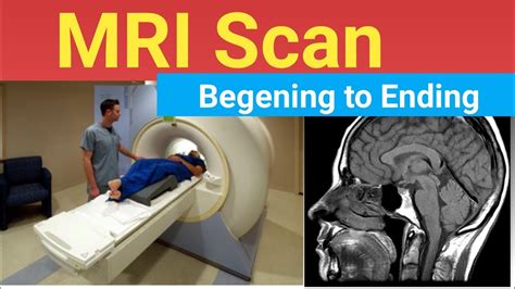 MRI Scan Procedure In Detail YouTube