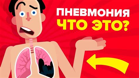 Пневмония - объяснение. - YouTube