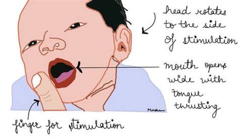 Neonatal Reflexes List