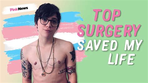 Ryan Cassata Top Surgery Scars And Recovery Youtube