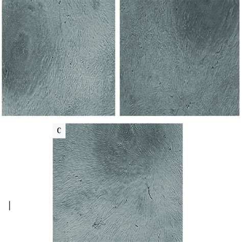 Morphological Examination Of Rpe Normal Human Retina Cells Light