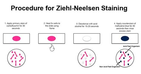 Zn Staining Procedure Principle Method And Results Rbr Life Science