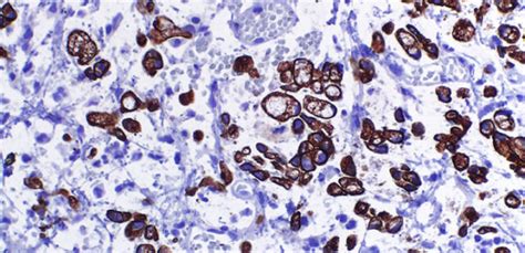 Inmunohistoqu Mica T Cnica Esencial Para El Diagn Stico Labpap