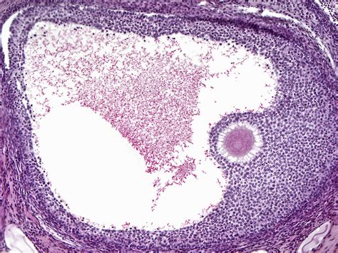 Ovarian Follicle Histology