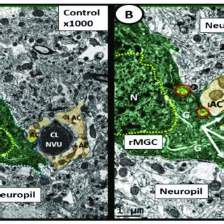 Ramified Surveilling Microglia Cells Rmgcs In Control Non Diabetic