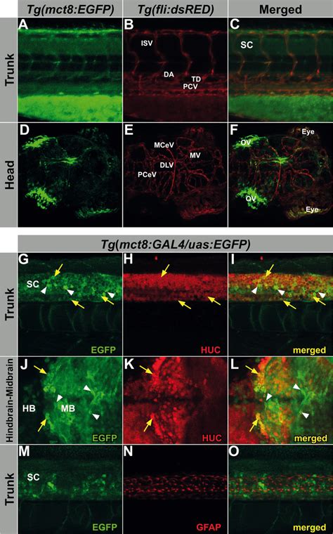 Mct8 Is Expressed In The Vascular System And In Neurons Colocalization