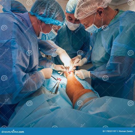 Process Of Trauma Surgery Operation Group Of Surgeons In Operating