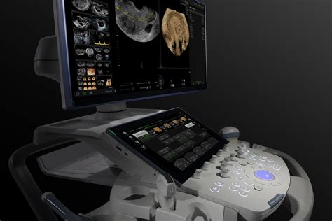 Fast Forward Voluson™ Signature Series Ge Healthcare