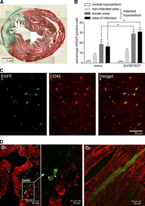 Homing Of BM Derived Cells In The Infarcted Myocardium A