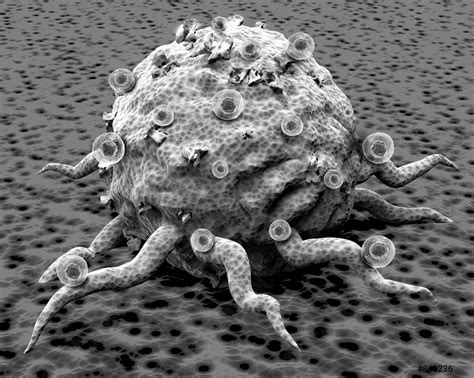 Cancer Cells Viewed Under An Electron Microscope 3d Illustration