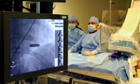 Worlds Smallest Leadless Heart Pacemaker Implanted At Ohio State