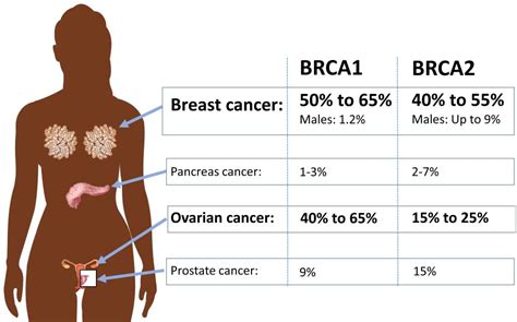 Cáncer de Mama Metastásico Laboratorios Bagó