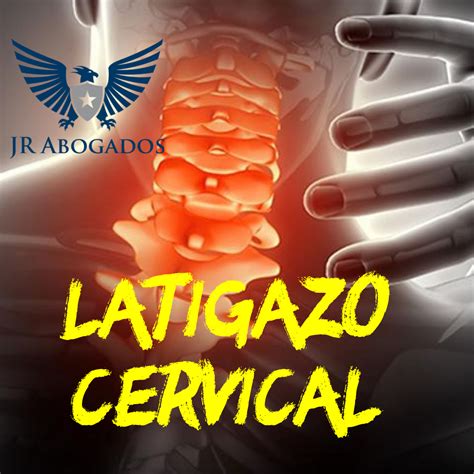 Indemnizacion Por Esguince O Latigazo Cervical Jr Abogados