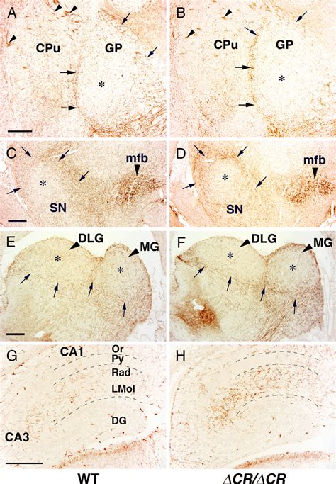 Serotonergic Fibers In The Developing Brain Of Pcdha Cr Cr Mice A D