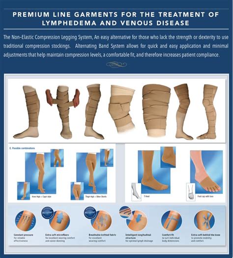 List 103 Pictures Pictures Of Lymphedema In The Legs Updated