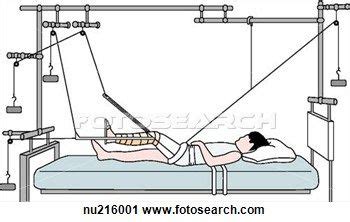 Principle Of Balanced Suspension Traction The Counterweight And