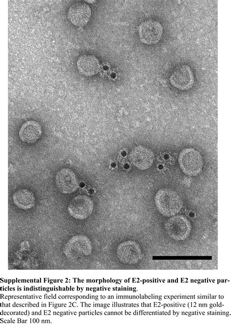 Ultrastructural And Biophysical Characterization Of Hepatitis C Virus